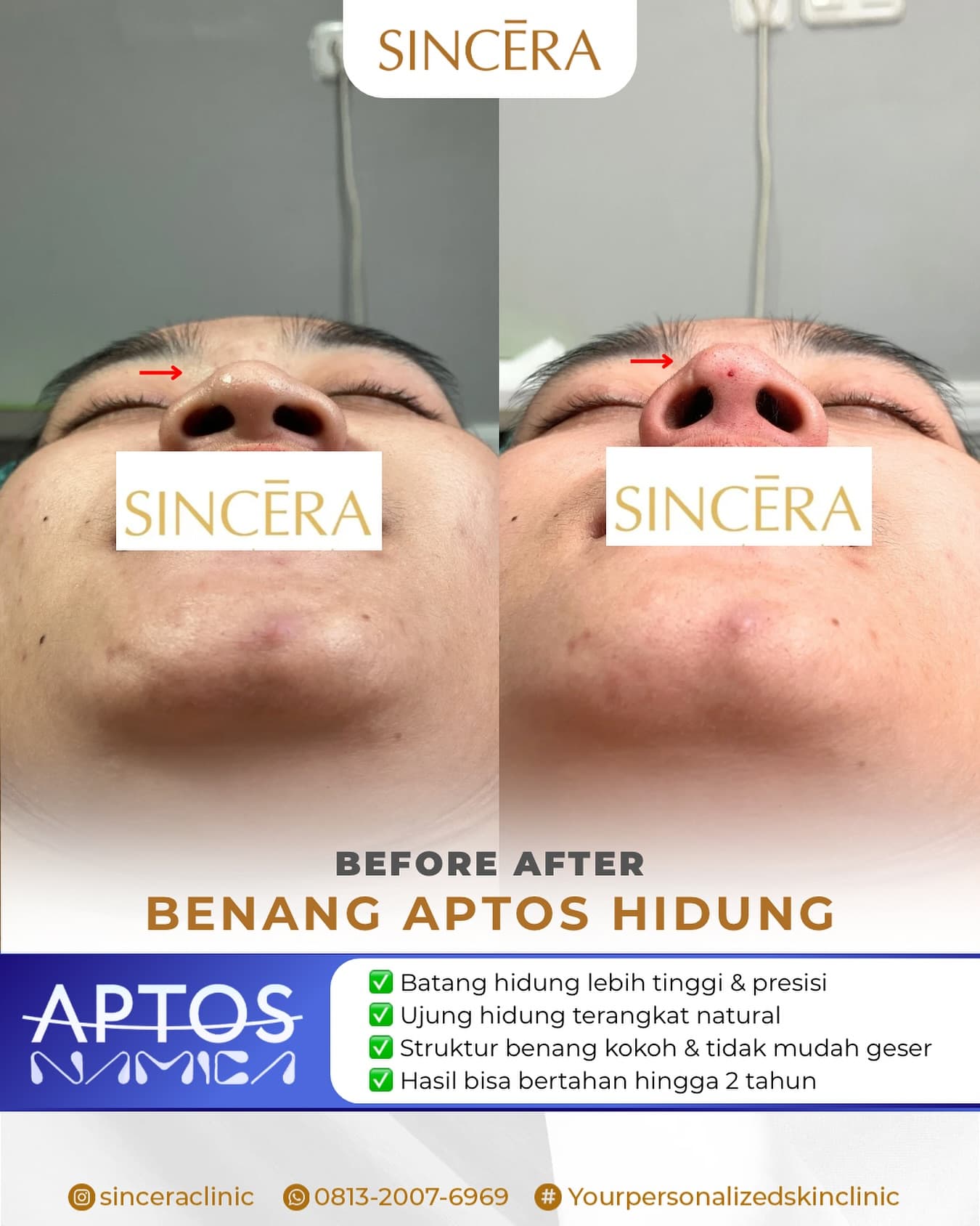 Before & after result 1