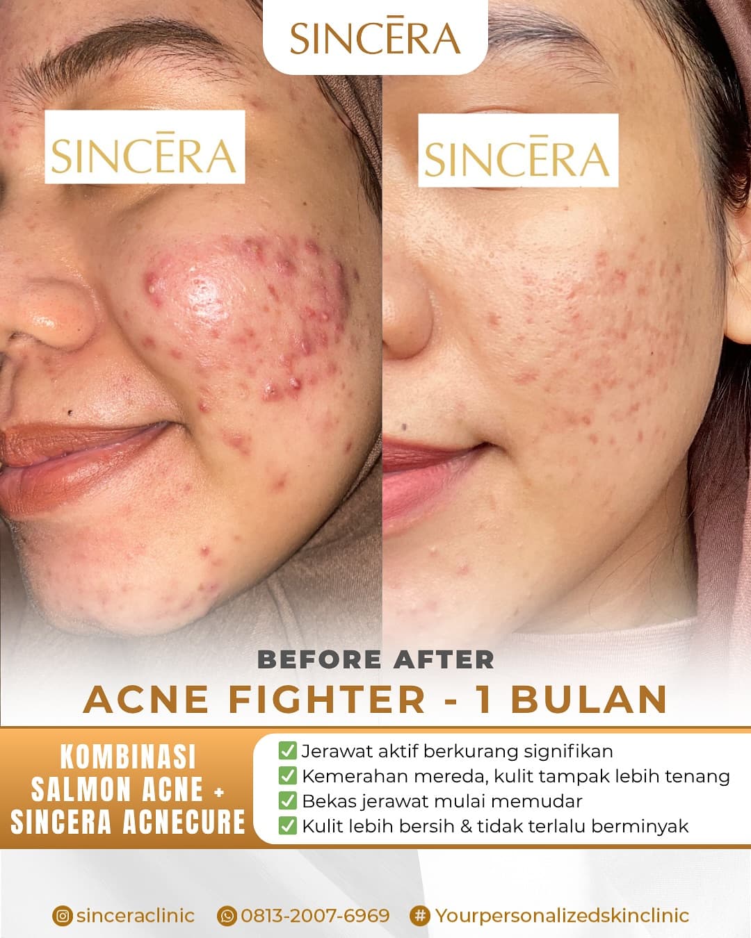 Before & after result 2