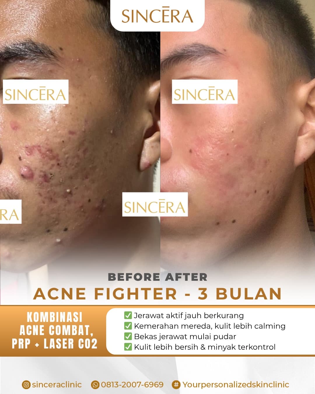 Before & after result 3